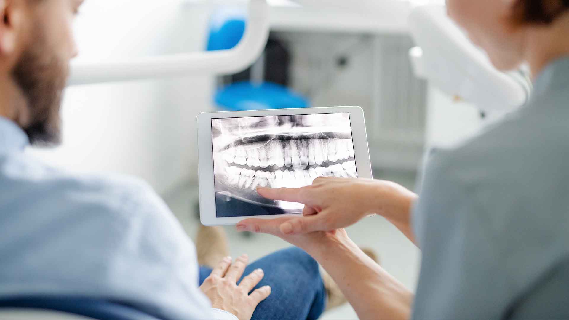 Moderne-Wurzelbehandlung-hamburg-altona Moderne Wurzelbehandlung in Hamburg-Altona